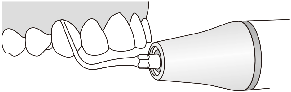 Сфера применения наконечника для скалера